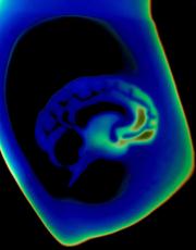 Imagen termal de un cerebro