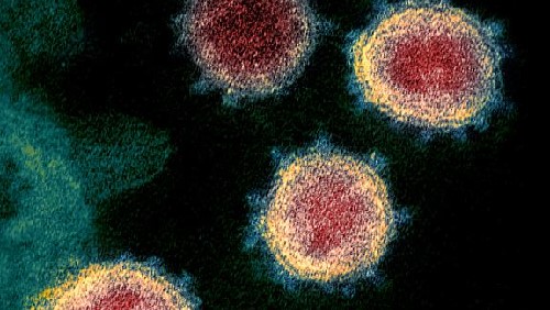 Novel Coronavirus, SARS-Cov-2 Image | NIH