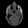 Specimen from the Visible Human Male - Head subset