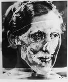 Superimposed photographs, Mrs. Ruxton and skull no.2, 1935