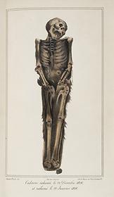 Studies of the effects of decomposition on exhumed bodies, 1831