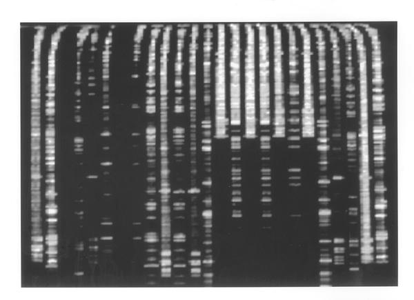 DNA chart